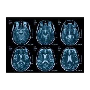 AppFactory Expert PET Film, Transparent, 150 g/qm, A3, 250 Blatt