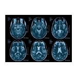 AppFactory Expert PET Film, Transparent, 150 g/qm, SRA3, 100 Blat